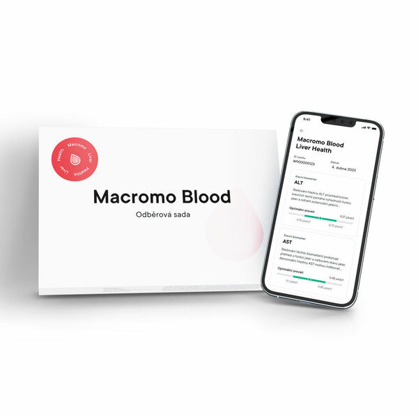 MACROMO krevní test Zdravá játra porovnat ceny