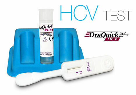 HIV/AIDS OraQuick ADVANCE HIV-1/2 Rapid Antib.test porovnat ceny