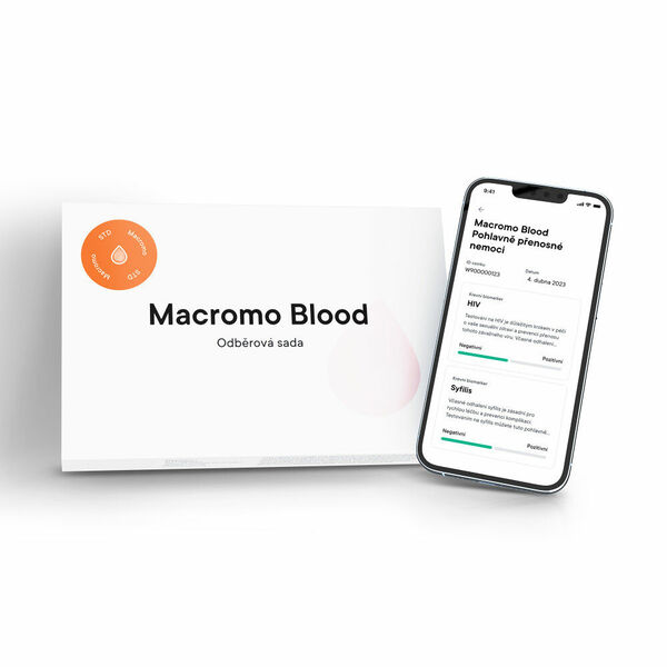 MACROMO krevní test Pohlavně přenosné nemoci porovnat ceny