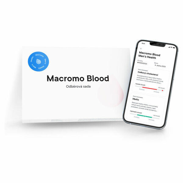 MACROMO krevní test Muž pro posouzení celkového zdraví mužů porovnat ceny